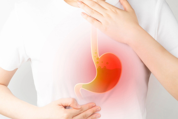 GERD vs. Acid Reflux: Understanding the Differences and Treatment