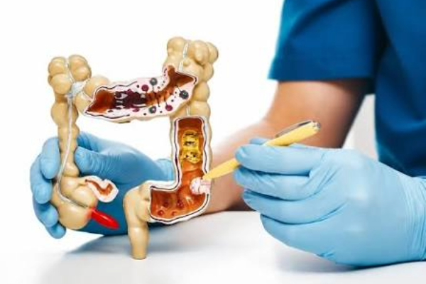Hidden Warning Signs of Colon Cancer: When Should You See a Gastroenterologist?