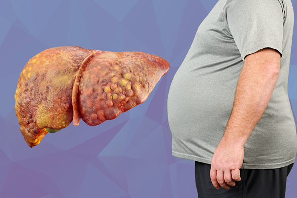 The Silent Illness You Must Not Ignore: Fatty Liver Disease