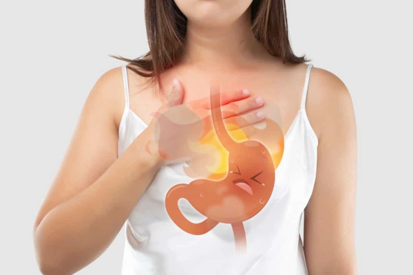 Understanding Acid Reflux, GERD, and Chronic Heartburn