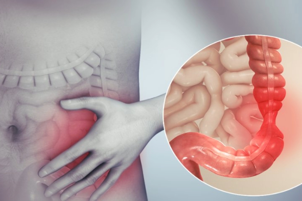 Why Are Young Indians Facing More Digestive Problems? Early Signs of IBS, Gut Imbalance & When to See a Gastroenterologist